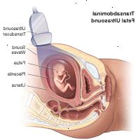 Ilustrace transabdominální plodu ultrazvukem