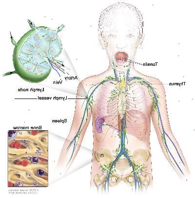 Lymfatický systém, kresba ukazuje lymfatických cév a lymfatických orgánů, včetně lymfatických uzlin, mandlí, brzlíku, slezině a kostní dřeni. Jedna vložka ukazuje vnitřní strukturu lymfatických uzlin a lymfatických cév spojených s šipkami ukazují, jak lymfatických (čiré tekutiny) se pohybuje dovnitř a ven z lymfatických uzlin. Další vložka ukazuje zblízka kostní dřeně s krvinek.