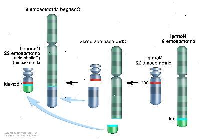 Philadelphia chromozom, tři-panel výkres ukazuje kus chromozomu 9 a kousek chromozomu 22 odlomení a obchodní místa, vytváří změněný chromozom 22 s názvem Philadelphia chromozom. V levém panelu, výkres ukazuje normální chromozom 9 s ABL genu a normálním chromozomu 22 s BCR genu. Ve středovém panelu, výkres ukazuje chromozom 9 rozpadá v abl genu a chromozomu 22 rozpadá pod BCR genu. V pravém panelu, výkres ukazuje chromozom 9 s kusem z chromozomu 22 připojené a 22. chromozomu s kusem z chromozomu 9, obsahující část abl genu připojené. Změněné chromozomu 22 s BCR-ABL genu se nazývá chromozom Philadelphia.