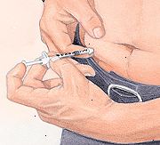 Pacient injekční inzulín do břicha