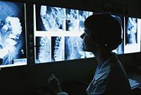 Obrázek lékaře prohlížení iriografie x-ray filmy