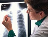 Obrázek ženské radiolog čtení rentgen