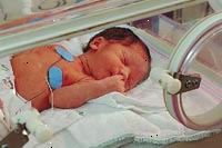 Obrázek dítěte v novorozenecké jednotce intenzivní péče