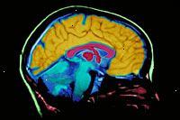Obraz MRI mozku skenování filmu