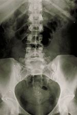 Foto bederní x-ray