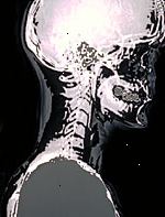 Obraz rentgen hlavy