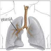 Dva způsoby, astma omezuje dýchání