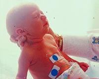 Obrázek novorozence v novorozenecké jednotce intenzivní péče