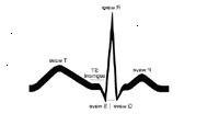 Ilustrace základní EKG sledování