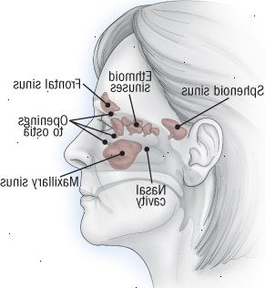 Anatomie vedlejších nosních dutin
