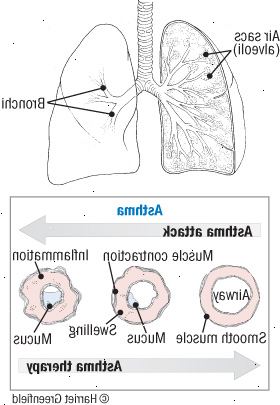 Astma: reverzibilní onemocnění